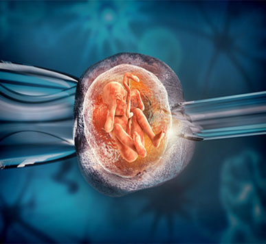 IVF (Test Tube Baby)